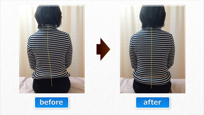 座っている時にどうしても体がゆがんでしまうAさん。