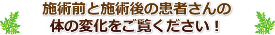 施術前と施術後の患者さんの体の変化をご覧ください!